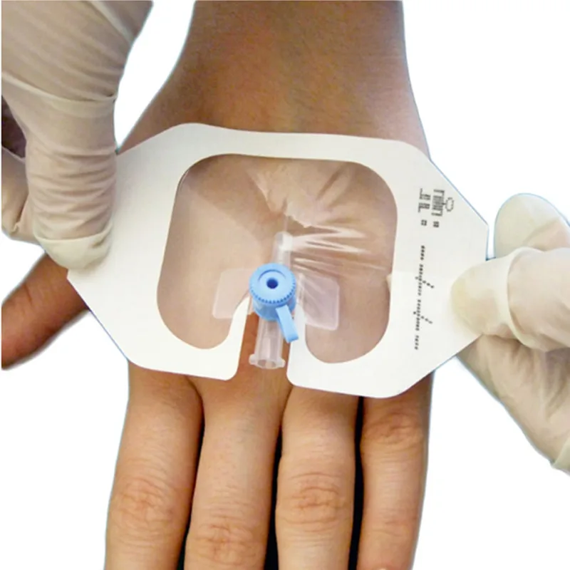 Перевязочные материалы для внутривенных вливаний с U-образным вырезом, стерильная прозрачная дышащая водонепроницаемая полиуретановая пленка, пластырь для перевязки ран Изображение 0